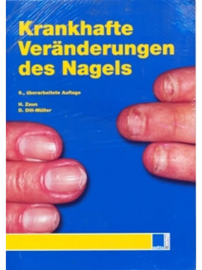 Krankhafte Veränderungen des Nagels